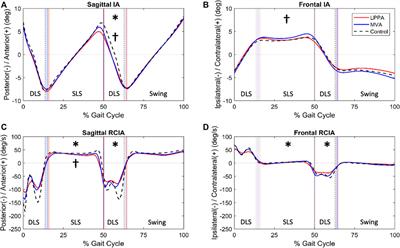 Mid-vastus total knee arthroplasty for medial osteoarthritis recovers gait balance control better than lateral parapatellar approach three months post-surgery